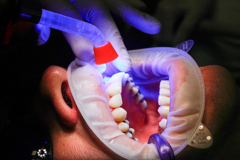 Poszukiwania fachowego dentysty gdzie szukać?